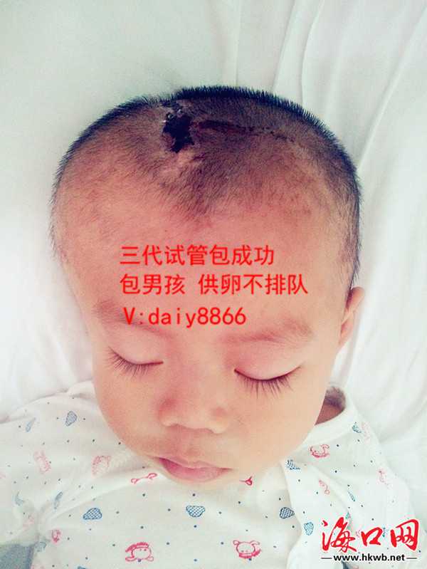 武汉国内医院能做供卵试管_武汉助孕怎么找_怀孕了吗